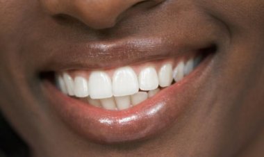 Innovation Japonaise: Un Nouveau Traitement pour Régénérer les Dents Naturellement